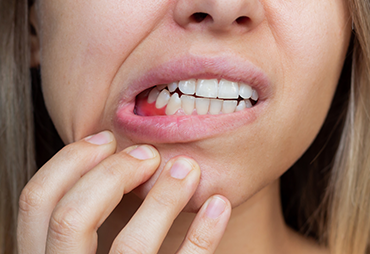 Treatment of Gum Diseases