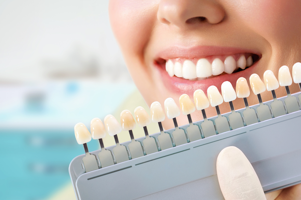 Aesthetic (Cosmetic) Dentistry in Turkey